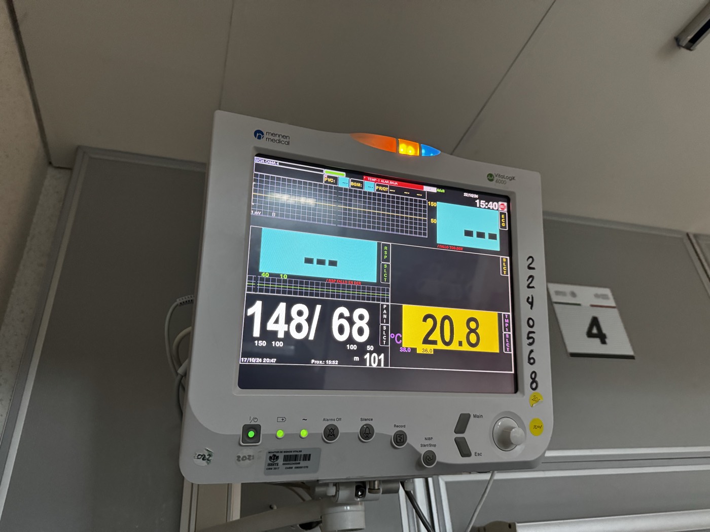 Monitor de signos vitales encendido